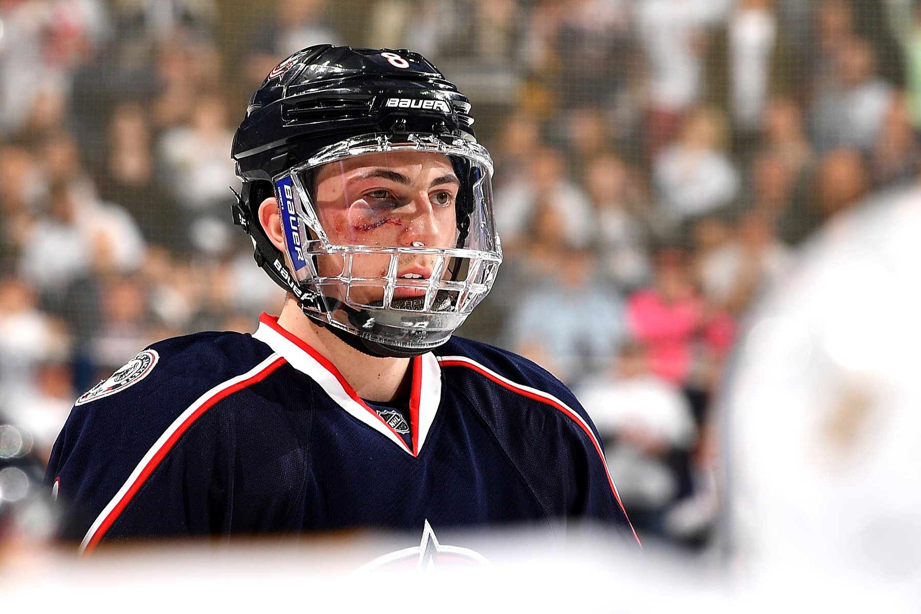 Хоккей без маски. Зак Веренски. Zach Werenski NHL. Маска хоккей стига. Лицо хоккей стига.